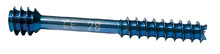 Titan Schraube mit freundlicher Genehmigung von WRIGHT MEDICAL image002.jpg